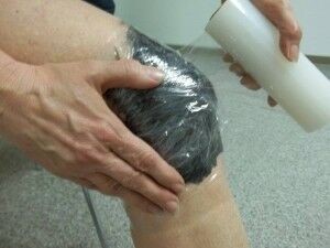 Лечение колена компрессом с мумие